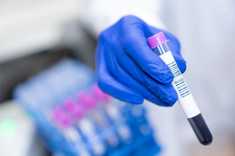 In a laboratory focused on arthritis research, a person wearing blue gloves holds a test tube with a barcode and purple cap. In the background, there is a blurred tray filled with more test tubes, symbolizing the ongoing quest for breakthroughs in understanding this condition.